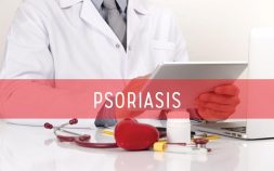 5 Ways To Treat Scalp Plaque Psoriasis At Home, All About Psoriasis: From Plaque Psoriasis Treatments to Pustular, chronic plaque psoriasis treatment, Eczema, Fever with rashes, Is It Psoriasis? Treatment For Itching Skin, Itchy rash, Itchy scalp, medications plaque psoriasis, medications psoriasis, medicine for plaque psoriasis, medicine plaque psoriasis, medicines plaque psoriasis, mild scalp plaque psoriasis treatment, palque psoriasis treatment, palque psoriasis treatment options, pictures of plaque psoriasis, Pictures of scalp plaque psaq, plague psoriasis drug, plague psoriasis treatment, plague psoriasis treatment options, plague psoriasis treatments, plaque psoriasis drug, plaque psoriasis drug treatment, plaque psoriasis durg, plaque psoriasis medication, plaque psoriasis remedies, plaque psoriasis remedy, plaque psoriasis scalp, plaque psoriasis treatment, plaque psoriasis treatment options, plaque psoriasis treatments, plaque psoriasisn remedies, plaque psoriasistreatment options, psoriasis and treatment, psoriasis medication, psoriasis medications, psoriasis medicines, psoriasis plaque, psoriasis treatment, psoriasis treatment info, psoriasis treatment option, psoriasis treatment options, Psoriasis treatments, Rash on 6 month old, Rash on ball, Red rash pictures, remedy psoriasis, scalp psoriasis treatment, Scalp psorisasi, severe plaque psoriasis treatment, severe psoriasis treatment, severe psoriasis treatments, skin psoriasis treatment, Skin rash, Skin rashes, treat plaque psoriasis, treating plaque psoriasis, treating plaque psoriasis treatment, treating psoriasis, treatment for psoriasis rash, treatment psoriasis, what causes ichness on body, What Does Your Skin Rash Mean?, What is Plaque Psoriasis?, what is psoriasis, What You Can Do To Relieve Psoriasis, what’s a line of small red dots on arm, Why does my skin ich